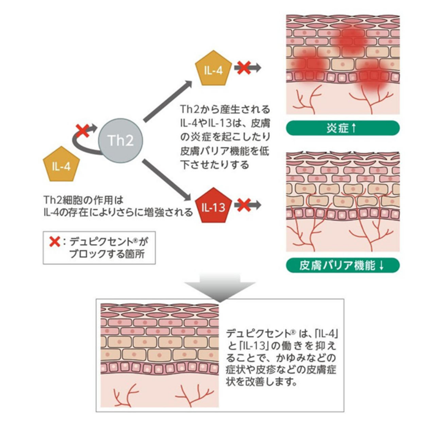 デュピクセント